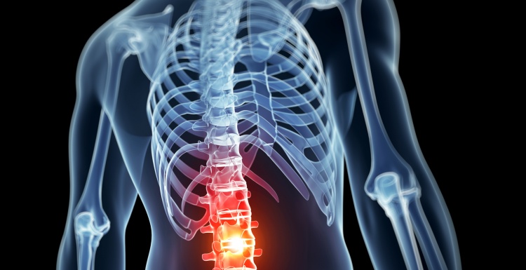 Photo: 3D rendered graphic of a human torso with highlighted backbone;...